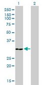 Monoclonal Anti-ANXA5 antibody produced in mouse clone 1F4-1A5, purified immunoglobulin, buffered aqueous solution