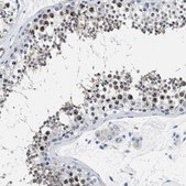 Anti-PARG antibody produced in rabbit Prestige Antibodies&#174; Powered by Atlas Antibodies, affinity isolated antibody, buffered aqueous glycerol solution