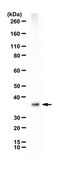 Anti-Aspa/Nur7 Antibody from rabbit, purified by affinity chromatography