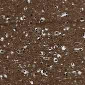 Anti-GAP43 antibody produced in rabbit Prestige Antibodies&#174; Powered by Atlas Antibodies, affinity isolated antibody, buffered aqueous glycerol solution