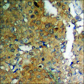 Anti-phospho-Adrenergic Receptor B2 (pSer355+Ser356) antibody produced in rabbit affinity isolated antibody