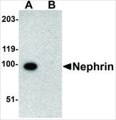 Anti-Nephrin antibody produced in rabbit affinity isolated antibody, buffered aqueous solution