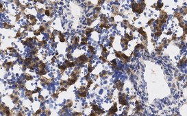 Anti-AFP Antibody, clone 3B7 ZooMAb® Rabbit Monoclonal recombinant, expressed in HEK 293 cells