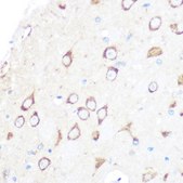 Anti-MSR1 Antibody, clone 10O8B0, Rabbit Monoclonal