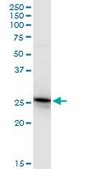 Anti-GSTA4 antibody produced in rabbit purified immunoglobulin, buffered aqueous solution