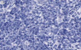 Anti-CXCL10 Antibody, clone 3F14 ZooMAb&#174; Rabbit Monoclonal recombinant, expressed in HEK 293 cells