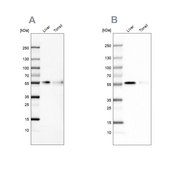 Anti-CD14 antibody produced in rabbit Prestige Antibodies&#174; Powered by Atlas Antibodies, affinity isolated antibody, buffered aqueous glycerol solution
