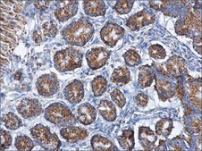 Monoclonal Anti-Citrate synthetase antibody produced in mouse clone GT1761, affinity isolated antibody