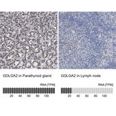 Anti-GOLGA2 antibody produced in rabbit Prestige Antibodies&#174; Powered by Atlas Antibodies, affinity isolated antibody, buffered aqueous glycerol solution, Ab1