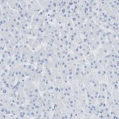Anti-MYH11 antibody produced in rabbit Prestige Antibodies&#174; Powered by Atlas Antibodies, affinity isolated antibody, buffered aqueous glycerol solution