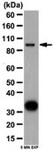 Anti-Autotaxin Antibody from rabbit, purified by affinity chromatography