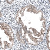 Anti-HTR1E antibody produced in rabbit Prestige Antibodies&#174; Powered by Atlas Antibodies, affinity isolated antibody, buffered aqueous glycerol solution