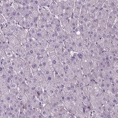 Anti-JAK3 antibody produced in rabbit Prestige Antibodies&#174; Powered by Atlas Antibodies, affinity isolated antibody, buffered aqueous glycerol solution