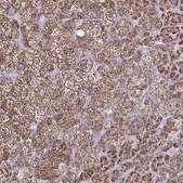 Anti-CYP11A1 antibody produced in rabbit Prestige Antibodies&#174; Powered by Atlas Antibodies, affinity isolated antibody, buffered aqueous glycerol solution