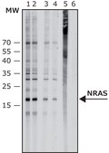 Anti-NRAS (internal) antibody produced in rabbit affinity isolated antibody