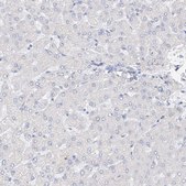 Anti-RSPH4A antibody produced in rabbit Prestige Antibodies&#174; Powered by Atlas Antibodies, affinity isolated antibody, buffered aqueous glycerol solution