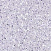Anti-CYP11B2 antibody produced in rabbit Prestige Antibodies&#174; Powered by Atlas Antibodies, affinity isolated antibody, buffered aqueous glycerol solution