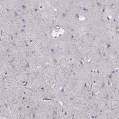 Anti-GRIK4 Prestige Antibodies&#174; Powered by Atlas Antibodies, affinity isolated antibody