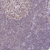 Anti-PTPN2 antibody produced in rabbit Prestige Antibodies&#174; Powered by Atlas Antibodies, affinity isolated antibody, buffered aqueous glycerol solution