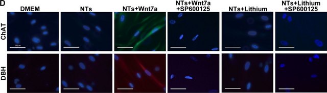 Anti-Choline Acetyltransferase Antibody, clone 1E6 ascites fluid, clone 1E6, Chemicon&#174;