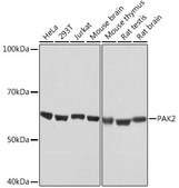 Anti-PAK2 Antibody, clone 2Y7I2, Rabbit Monoclonal