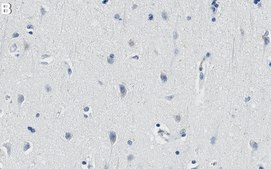Anti-ALK Antibody, clone 1D13 ZooMAb&#174; Rabbit Monoclonal recombinant, expressed in HEK 293 cells