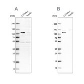 Anti-SP1 antibody produced in rabbit Ab1, Prestige Antibodies&#174; Powered by Atlas Antibodies, affinity isolated antibody, buffered aqueous glycerol solution