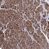 Anti-MYLK3 Prestige Antibodies&#174; Powered by Atlas Antibodies, affinity isolated antibody