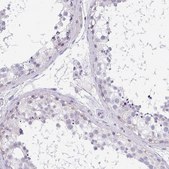 Anti-CACNA1S antibody produced in rabbit Prestige Antibodies&#174; Powered by Atlas Antibodies, affinity isolated antibody, buffered aqueous glycerol solution