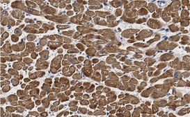 Anti-Cardiac Troponin I Antibody, clone 1F23, ZooMAb® Rabbit Monoclonal recombinant, expressed in HEK 293 cells