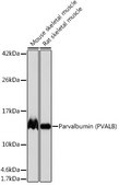 Anti-Parvalbumin (PVALB) Antibody, clone 6C7K6, Rabbit Monoclonal