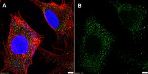 Anti-TYRP1 Antibody, clone 3L4 ZooMAb&#174; Rabbit Monoclonal recombinant, expressed in HEK 293 cells
