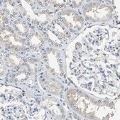 Anti-FEN1 antibody produced in rabbit Prestige Antibodies&#174; Powered by Atlas Antibodies, affinity isolated antibody, buffered aqueous glycerol solution