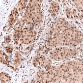 Monoclonal Anti-Msh3 Antibody Produced In Mouse Prestige Antibodies&#174; Powered by Atlas Antibodies, clone CL14059, affinity isolated antibody, buffered aqueous glycerol solution