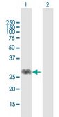 Anti-FNTA antibody produced in mouse purified immunoglobulin, buffered aqueous solution