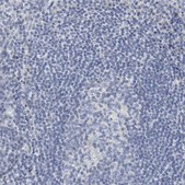 Anti-SALL2 antibody produced in rabbit Prestige Antibodies&#174; Powered by Atlas Antibodies, affinity isolated antibody, buffered aqueous glycerol solution