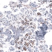 Anti-L1CAM antibody produced in mouse Prestige Antibodies&#174; Powered by Atlas Antibodies, clone CL12984, purified by using Protein A, buffered aqueous glycerol solution