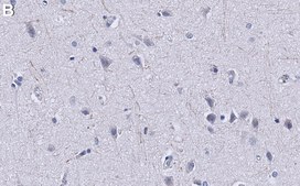 Anti-PTEN Antibody, clone A2b1 ZooMAb&#174; Mouse Monoclonal recombinant, expressed in HEK 293 cells