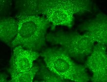Monoclonal Anti-CACNB2 antibody produced in mouse clone S8B-1, 1 mg/mL, purified immunoglobulin
