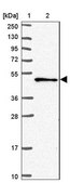 Anti-SNX5 antibody produced in rabbit Prestige Antibodies&#174; Powered by Atlas Antibodies, affinity isolated antibody, buffered aqueous glycerol solution