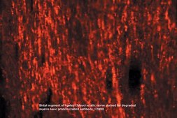 Anti-Myelin Basic Protein Antibody serum, Chemicon&#174;