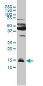 Monoclonal Anti-IFITM3 antibody produced in mouse clone 4C8-1B10, purified immunoglobulin, buffered aqueous solution