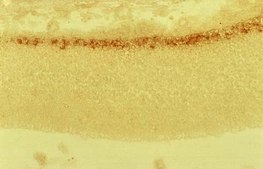 Anti-Reelin Antibody, a.a. 164-496 mreelin, clone G10 clone G10, Chemicon&#174;, from mouse