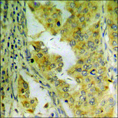 Anti-phospho-PI3-kinase p85-α/γ (pTyr467/199) antibody produced in rabbit affinity isolated antibody
