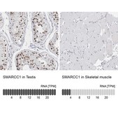Anti-SMARCC1 antibody produced in rabbit Prestige Antibodies&#174; Powered by Atlas Antibodies, affinity isolated antibody, buffered aqueous glycerol solution