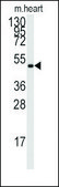 Anti-PRKAG1 (center) antibody produced in rabbit IgG fraction of antiserum, buffered aqueous solution