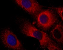 Anti-Collagen IV antibody, Mouse monoclonal clone J3-2, purified from hybridoma cell culture