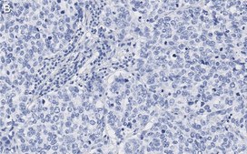 Anti-Skp2 Antibody, clone 1B13 ZooMAb&#174; Rabbit Monoclonal recombinant, expressed in HEK 293 cells