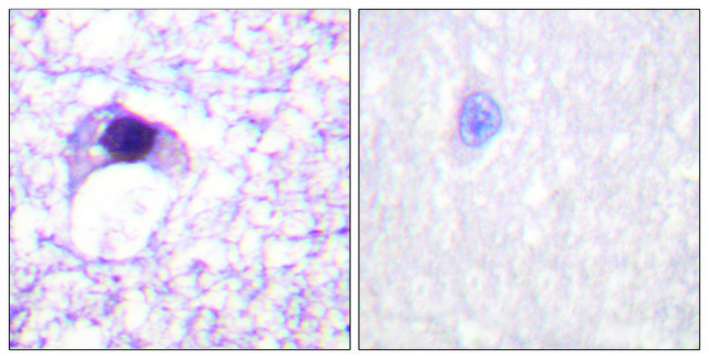 Anti-E2F6 antibody produced in rabbit affinity isolated antibody