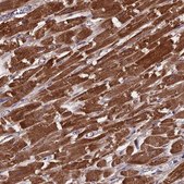 Anti-CS antibody produced in rabbit Prestige Antibodies&#174; Powered by Atlas Antibodies, affinity isolated antibody, buffered aqueous glycerol solution